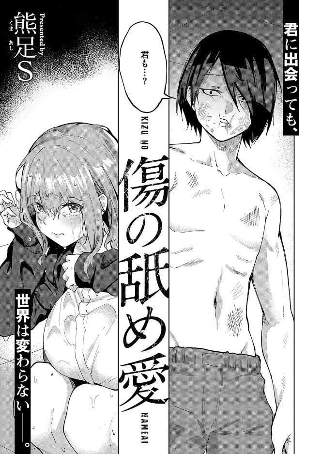 傷の舐め愛